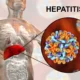 Mewaspadai Penularan Hepatitis B dari Ibu ke Anak Fakta yang Perlu Diketahui