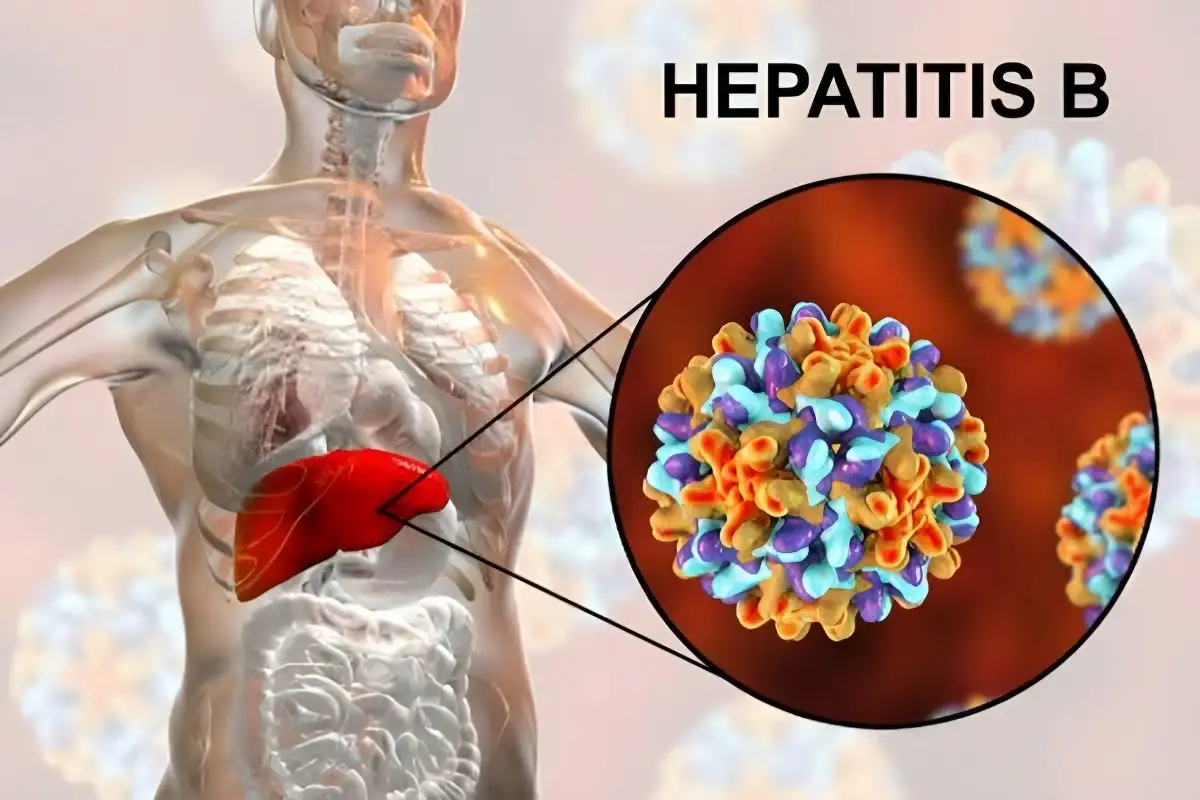 Mewaspadai Penularan Hepatitis B Dari Ibu Ke Anak: Fakta Yang Perlu ...