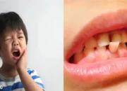 Diabetes Melitus pada Anak: Tantangan Kesehatan dan Peran Vital Orang Tua dalam Menjaga Kesehatan Gigi dan Mulut